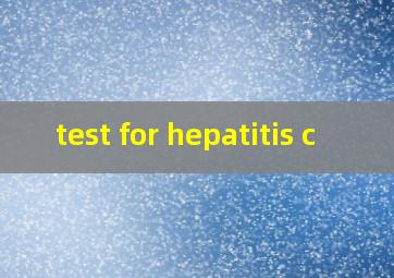 test for hepatitis c